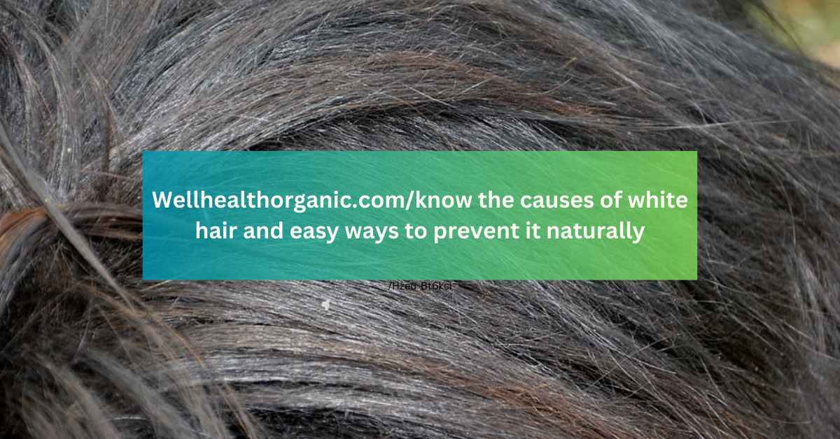 Wellhealthorganic.comknow the causes of white hair and easy ways to prevent it naturally