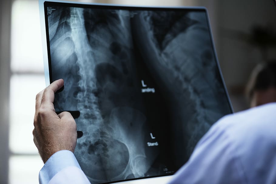 X-Rays at a Pain Management Clinic