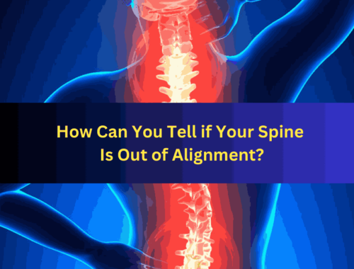 How Can You Tell if Your Spine Is Out of Alignment